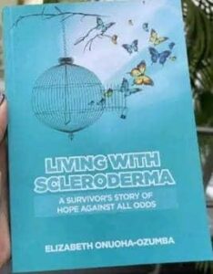 Living with Scleroderma